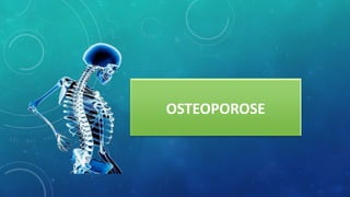 OSTEOPOROSE
 