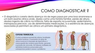 COMO DIAGNOSTICAR ?
• O diagnóstico correto desta doença via de regra passa por uma boa anamnese e
um bom exame clínico onde, dados como uma história familiar, perda de altura,
abaixa ingesta de cálcio na infância, falta de esporte na juventude, sedentarismo,
menopausa precoce, uso de determinadas medicações, e a existência de doenças
associadas já permitem ao clínico um primeiro diagnóstico.
 