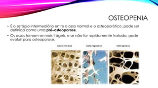 OSTEOPENIA
• É o estágio intermediário entre o osso normal e o osteoporótico, pode ser
definida como uma pré–osteoporose.
• Os ossos tornam-se mais frágeis, e se não for rapidamente tratada, pode
evoluir para osteoporose.
 