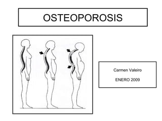 OSTEOPOROSIS Carmen Valeiro ENERO 2009 