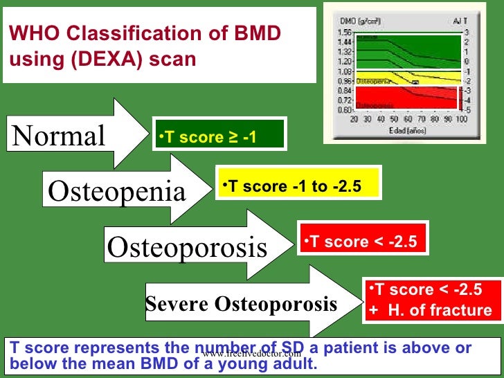 Osteoporosis