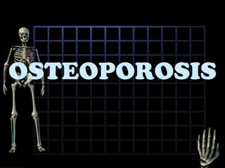 OSTEOPOROSIS 