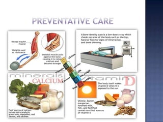 Risk factorsAbsence of menstrual periodsDrinking large amounts of alcoholFamily historyHistory of hormone treatment for prostate or breast cancerLow body weightSmokingToo little calcium in 	diet
