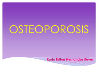 OSTEOPOROSIS

     Karla Esther Hernández Reyes
 