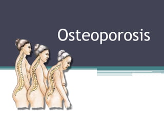 Osteoporosis
 