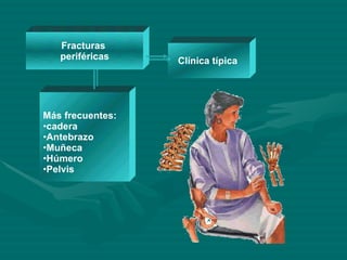 Fracturas  periféricas Clínica típica  Más frecuentes: cadera Antebrazo Muñeca Húmero Pelvis 