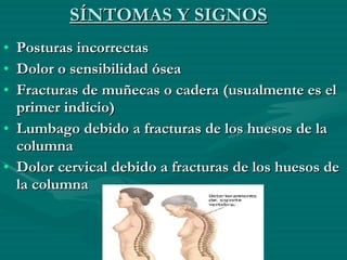 SÍNTOMAS Y SIGNOS Posturas incorrectas  Dolor o sensibilidad ósea  Fracturas de muñecas o cadera (usualmente es el primer indicio)  Lumbago debido a fracturas de los huesos de la columna  Dolor cervical debido a fracturas de los huesos de la columna  