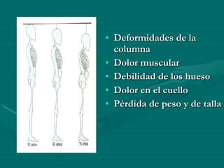 Deformidades de la columna Dolor muscular Debilidad de los hueso Dolor en el cuello Pérdida de peso y de talla 