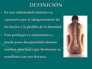 DEFINICIÓN Es una enfermedad sistémica se caracteriza por el adelgazamiento de los huesos y la pérdida de la densidad.  Esta patología es asintomática y puede pasar desapercibida durante muchos años hasta que finalmente se manifiesta con una fractura. 