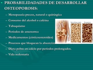 PROBABILIDADADES DE DESARROLLAR OSTEOPOROSIS: Menopausia precoz, natural o quirúrgica Consumo del alcohol o cafeína Tabaquismo Períodos de amenorrea Medicamentos (córticoesteroides) Procesos que bloquean la absorción intestinal de calcio. Dieta pobre en calcio por períodos prolongados. Vida sedentaria 