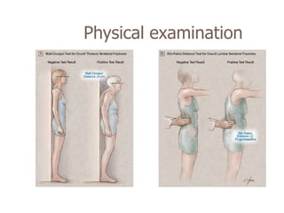 Physical examination
 