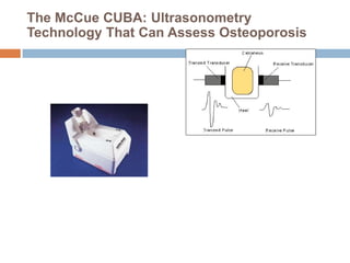 The McCue CUBA: Ultrasonometry
Technology That Can Assess Osteoporosis
 