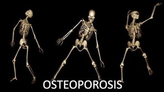 Osteoporosis