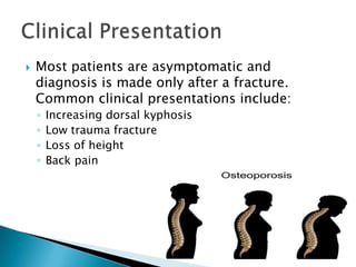 

Most patients are asymptomatic and
diagnosis is made only after a fracture.
Common clinical presentations include:
◦
◦
◦
◦

Increasing dorsal kyphosis
Low trauma fracture
Loss of height
Back pain

 