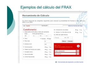 Ejemplos del cálculo del FRAX

 