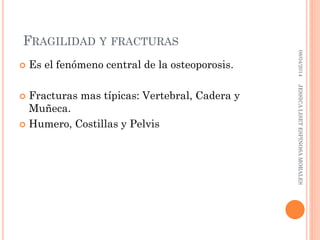 FRAGILIDAD Y FRACTURAS
 Es el fenómeno central de la osteoporosis.
 Fracturas mas típicas: Vertebral, Cadera y
Muñeca.
 Humero, Costillas y Pelvis
08/04/2014JESSICALISETESPINOSAMORALES
 
