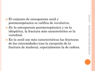  El conjunto de osteoporosis senil y
postmenopáusica se califica de involutiva.
 En la osteoporosis postmenopáusica y en la
idiopática, la fractura más característica es la
vertebral.
 En la senil son más características las fracturas
de las extremidades (con la excepción de la
fractura de muñeca), especialmente la de cadera.
08/04/2014JESSICALISETESPINOSAMORALES
 