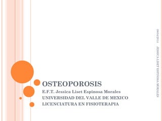 OSTEOPOROSIS
E.F.T. Jessica Liset Espinosa Morales
UNIVERSIDAD DEL VALLE DE MEXICO
LICENCIATURA EN FISIOTERAPIA
08/04/2014JESSICALISETESPINOSAMORALES
 