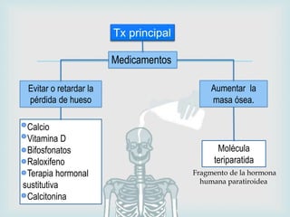 
Aumentar la
masa ósea.
Tx principal
Medicamentos
Evitar o retardar la
pérdida de hueso
Molécula
teriparatida
Calcio
Vitamina D
Bifosfonatos
Raloxifeno
Terapia hormonal
sustitutiva
Calcitonina
Fragmento de la hormona
humana paratiroidea
 