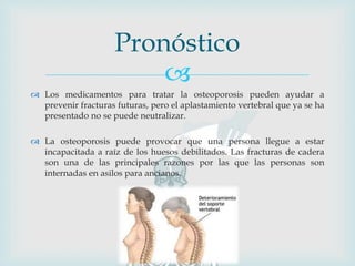 
 Los medicamentos para tratar la osteoporosis pueden ayudar a
prevenir fracturas futuras, pero el aplastamiento vertebral que ya se ha
presentado no se puede neutralizar.
 La osteoporosis puede provocar que una persona llegue a estar
incapacitada a raíz de los huesos debilitados. Las fracturas de cadera
son una de las principales razones por las que las personas son
internadas en asilos para ancianos.
Pronóstico
 
