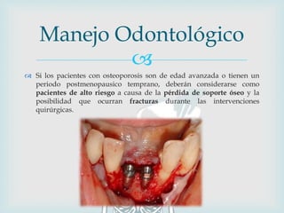 
 Si los pacientes con osteoporosis son de edad avanzada o tienen un
periodo postmenopausico temprano, deberán considerarse como
pacientes de alto riesgo a causa de la pérdida de soporte óseo y la
posibilidad que ocurran fracturas durante las intervenciones
quirúrgicas.
Manejo Odontológico
 