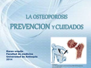 Karen urquijo
Facultad de medicina
Universidad de Antioquia
2014
Tomada de:
http://kinexpert.bligoo.com/content/view/1082742/Osteoporosis-
Generalidades.html
 