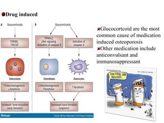 Drug induced 
Glucocortcoid are the most 
common cause of medication 
induced osteoporosis 
Other medication include 
anticonvulsant and 
immunosuppressant 
14 
 