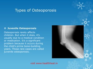 Types of Osteoporosis 
 Juvenile Osteoporosis 
Osteoporosis rarely affects 
children. But when it does, it’s 
usually due to a medical condition 
or medication. It’s a significant 
problem because it occurs during 
the child’s prime bone-building 
years. Those rare cases are called 
juvenile osteoporosis. 
visit www.healthheal.in 
 