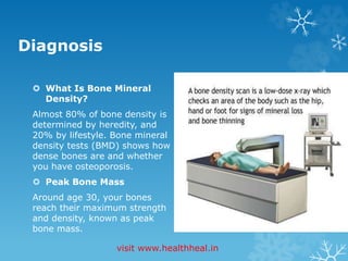 Diagnosis 
 What Is Bone Mineral 
Density? 
Almost 80% of bone density is 
determined by heredity, and 
20% by lifestyle. Bone mineral 
density tests (BMD) shows how 
dense bones are and whether 
you have osteoporosis. 
 Peak Bone Mass 
Around age 30, your bones 
reach their maximum strength 
and density, known as peak 
bone mass. 
visit www.healthheal.in 
 