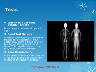 Tests 
 Who Should Get Bone 
Density Testing? 
Bone density normally drops with 
age. 
 Blood Test Markers 
Whether you're being screened or 
treated for osteoporosis, your 
doctor may order a blood or urine 
test to see the metabolism of 
bone. This provides clues to the 
progression of your disease. 
 Bone Densitometry 
Bone densitometry is a test like an 
X-ray that quickly and accurately 
measures the density of bone. 
visit www.healthheal.in 
 