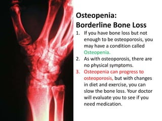 Osteopenia:
Borderline Bone Loss
1. If you have bone loss but not
enough to be osteoporosis, you
may have a condition called
Osteopenia.
2. As with osteoporosis, there are
no physical symptoms.
3. Osteopenia can progress to
osteoporosis, but with changes
in diet and exercise, you can
slow the bone loss. Your doctor
will evaluate you to see if you
need medication.
 
