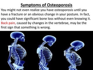Symptoms of Osteoporosis
You might not even realize you have osteoporosis until you
have a fracture or an obvious change in your posture. In fact,
you could have significant bone loss without even knowing it.
Back pain, caused by changes in the vertebrae, may be the
first sign that something is wrong.
 