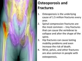 Osteoporosis and
Fractures
1. Osteoporosis is the underlying
cause of 1.5 million fractures every
year.
2. Spinal compression fractures are
the most common -- tiny fractures
that can cause the vertebrae to
collapse and alter the shape of the
spine.
3. Hip fractures can cause lasting
mobility problems and even
increase the risk of death.
4. Wrist, pelvic, and other fractures
are also common in people with
osteoporosis.
 