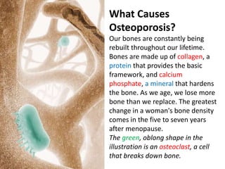 What Causes
Osteoporosis?
Our bones are constantly being
rebuilt throughout our lifetime.
Bones are made up of collagen, a
protein that provides the basic
framework, and calcium
phosphate, a mineral that hardens
the bone. As we age, we lose more
bone than we replace. The greatest
change in a woman's bone density
comes in the five to seven years
after menopause.
The green, oblong shape in the
illustration is an osteoclast, a cell
that breaks down bone.
 