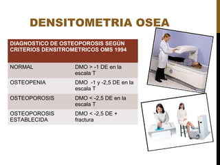 DENSITOMETRIA OSEA
DIAGNOSTICO DE OSTEOPOROSIS SEGÚN
CRITERIOS DENSITROMETRICOS OMS 1994
NORMAL DMO > -1 DE en la
escala T
OSTEOPENIA DMO -1 y -2,5 DE en la
escala T
OSTEOPOROSIS DMO < -2,5 DE en la
escala T
OSTEOPOROSIS
ESTABLECIDA
DMO < -2,5 DE +
fractura
 