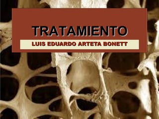 TRATAMIENTOTRATAMIENTO
LUIS EDUARDO ARTETA BONETTLUIS EDUARDO ARTETA BONETT
 