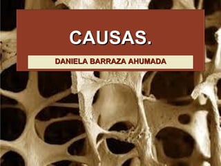 CAUSAS.CAUSAS.
DANIELA BARRAZA AHUMADADANIELA BARRAZA AHUMADA
 