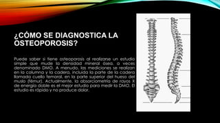 ¿CÓMO SE DIAGNOSTICA LA
OSTEOPOROSIS?
Puede saber si tiene osteoporosis al realizarse un estudio
simple que mude la densidad mineral ósea, a veces
denominado DMO. A menudo, las mediciones se realizan
en la columna y la cadera, incluida la parte de la cadera
llamada cuello femoral, en la parte superior del hueso del
muslo (fémur). Actualmente, la absorciometría de rayos X
de energía doble es el mejor estudio para medir la DMO. El
estudio es rápido y no produce dolor.
 