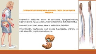 •Enfermedad endocrina: exceso de corticoides, hiperparatiroidismo,
hipertiroidismo, hipogonadismo, hiperprolactinemia, diabetes mellitus.
•Fármacos: corticoides, etanol, tabaco, barbitúricos, heparina.
•Inmovilización, insuficiencia renal crónica, hepatopatía, síndrome de
mala absorción, neoplasma maligna, etc.
 