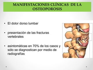 • El dolor dorso lumbar
• presentación de las fracturas
vertebrales
• asintomáticas en 70% de los casos y
sólo se diagnostican por medio de
radiografías
MANIFESTACIONES CLÍNICAS DE LA
OSTEOPOROSIS
 