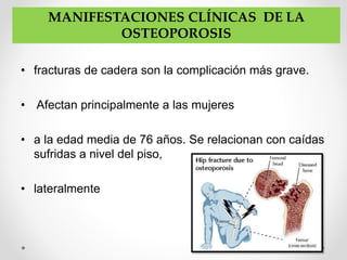 • fracturas de cadera son la complicación más grave.
• Afectan principalmente a las mujeres
• a la edad media de 76 años. Se relacionan con caídas
sufridas a nivel del piso,
• lateralmente
MANIFESTACIONES CLÍNICAS DE LA
OSTEOPOROSIS
 