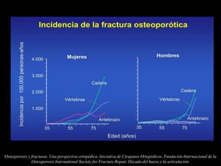 Osteoporosis y fracturas. Una perspectiva ortopédica. Iniciativa de Cirujanos Ortopédicos. Fundación Internacional de la
Osteoporosis International Society for Fracture Repair. Década del hueso y la articulación.
 