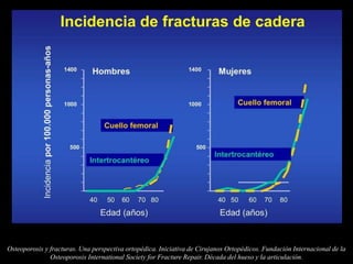 Osteoporosis y fracturas. Una perspectiva ortopédica. Iniciativa de Cirujanos Ortopédicos. Fundación Internacional de la
Osteoporosis International Society for Fracture Repair. Década del hueso y la articulación.
 