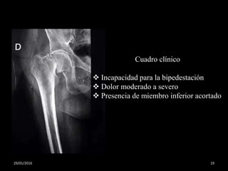 Cuadro clínico
 Incapacidad para la bipedestación
 Dolor moderado a severo
 Presencia de miembro inferior acortado
29/01/2016 19
 