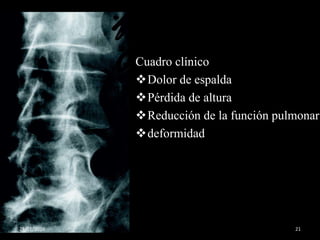 Cuadro clínico
Dolor de espalda
Pérdida de altura
Reducción de la función pulmonar
deformidad
29/01/2016 21
 