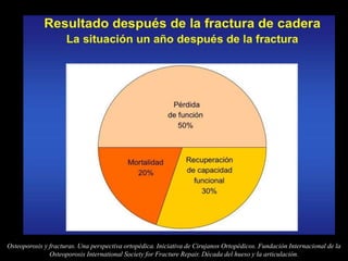 Osteoporosis y fracturas. Una perspectiva ortopédica. Iniciativa de Cirujanos Ortopédicos. Fundación Internacional de la
Osteoporosis International Society for Fracture Repair. Década del hueso y la articulación.
 