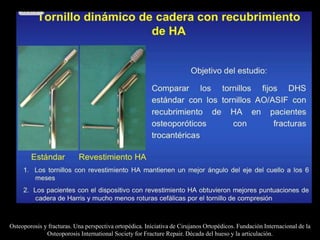 Osteoporosis y fracturas. Una perspectiva ortopédica. Iniciativa de Cirujanos Ortopédicos. Fundación Internacional de la
Osteoporosis International Society for Fracture Repair. Década del hueso y la articulación.
 