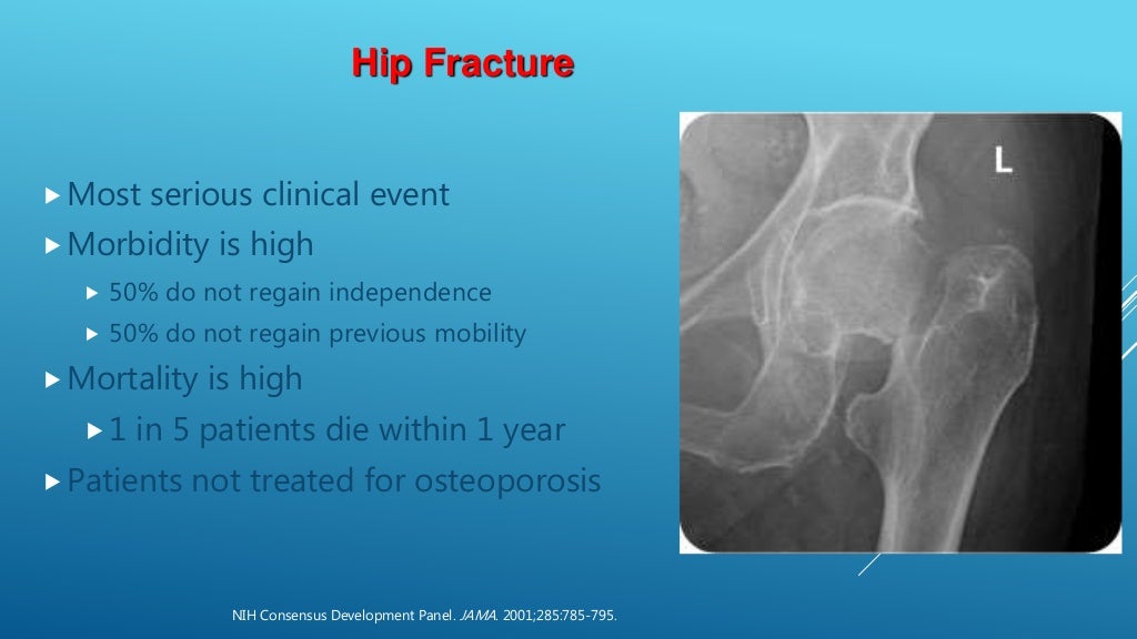 Osteoporosis surgical Spine tips and tricks