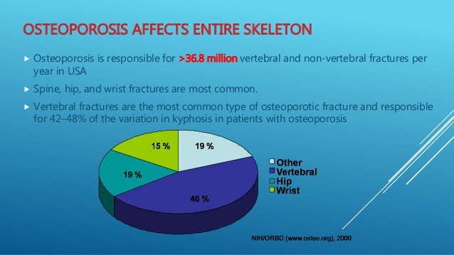 Osteoporosis surgical Spine tips and tricks spine skeletal system diagram 
