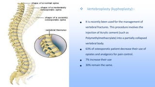  Vertebroplasty (kyphoplasty):-
 It is recently been used for the management of
vertebral fractures. This procedure involves the
injection of Acrylic cement (such as
Polymethylmethacrylate) into a partially collapsed
vertebral body.
 63% of osteoporotic patient decrease their use of
opiates and analgesics for pain control.
 7% increase their use
 30% remain the same.
27
 